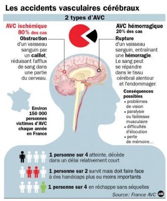 Un homme dans une chambre d’hôpital suite à accident vasculaire cérébral (AVC) est la première cause de mortalité pour les femmes et la première cause de handicap acquis de l’adulte. © DP / FHI