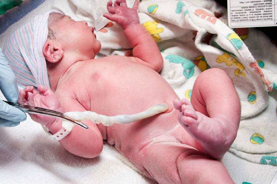 Faut il oui ou non conserver les cellules souches que contien le cordons du bebe