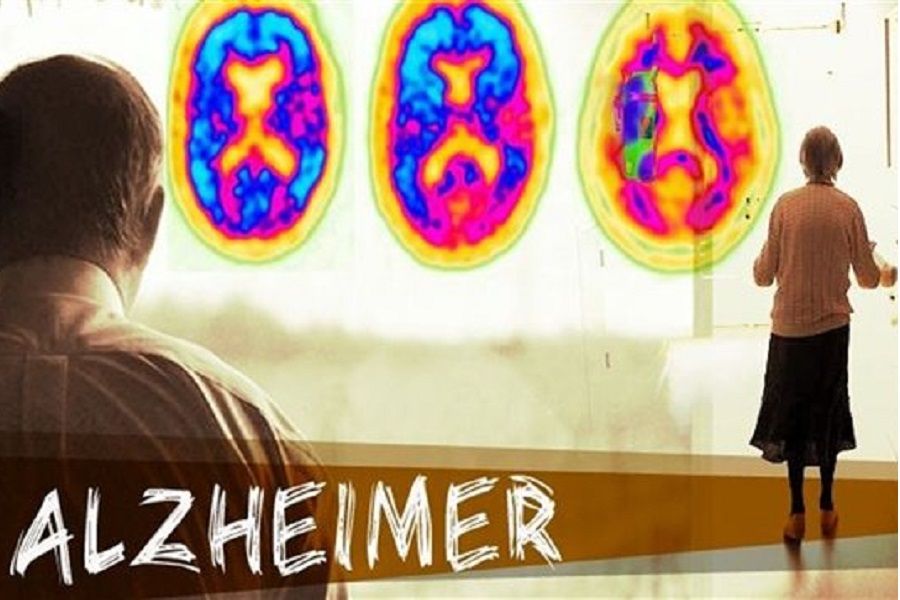 Maladie d Alzheimer